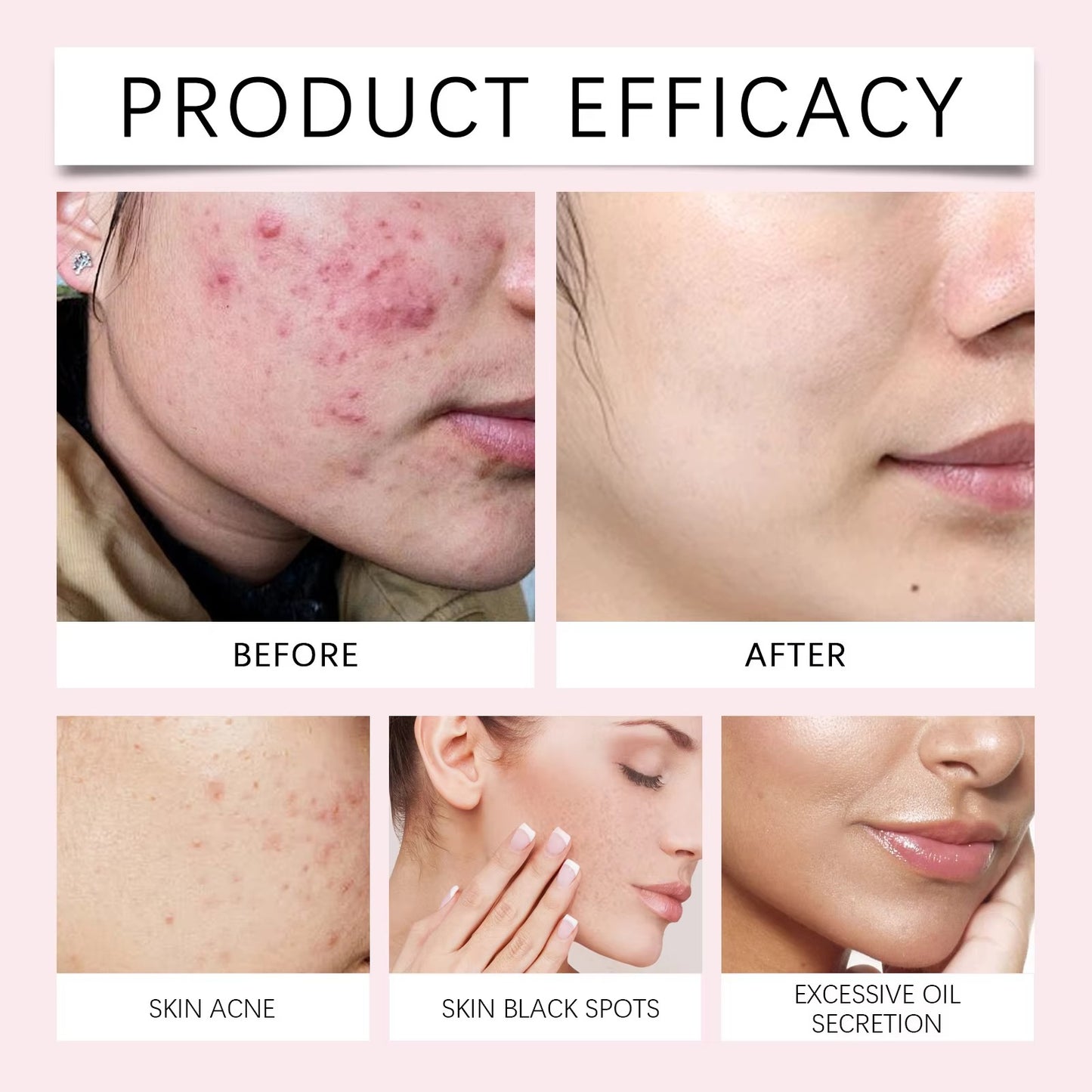 Turmeric Kojic Acid Face Pads 40 Brightening & Cleansing Discs for Dark Spots and Even Skin Tone